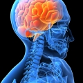 Epilepsijos priepuolis.jpg
